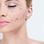 facial surgery correction