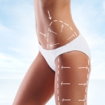 Female body with the drawing arrows on it. Fat lose, liposuction and cellulite removal concept.